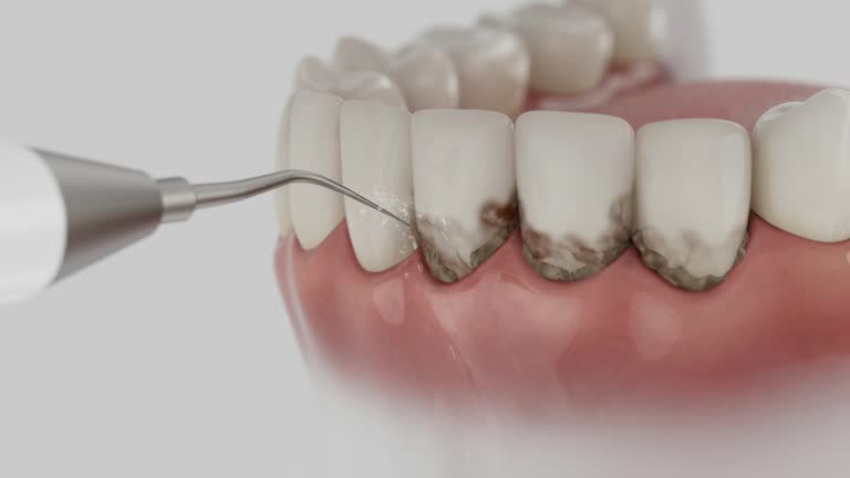 Reliable Dental Implants contractor in Red Lake, AZ by Smile Center Dentistry